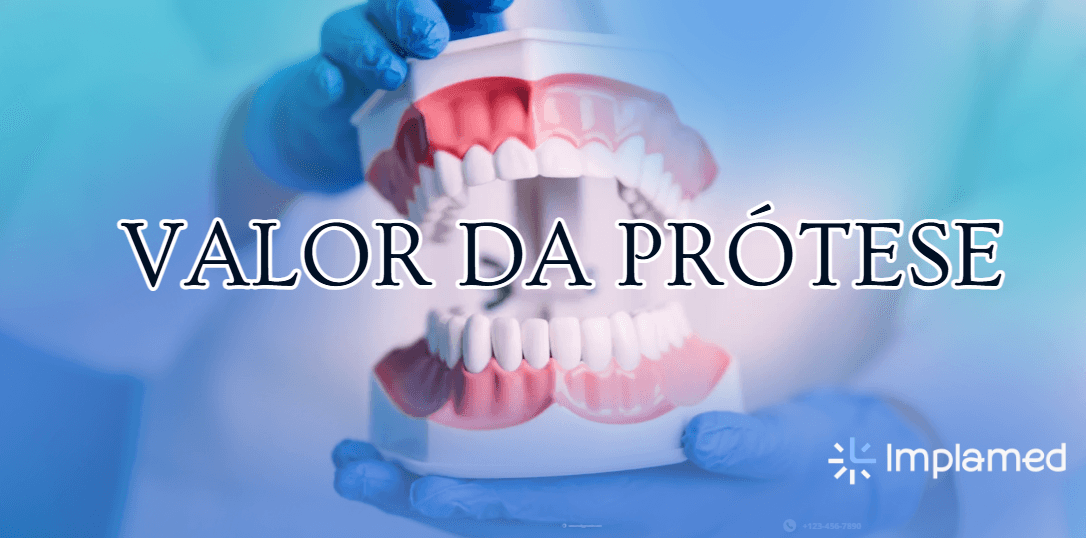 Valor da Prótese Dentária em Taubaté